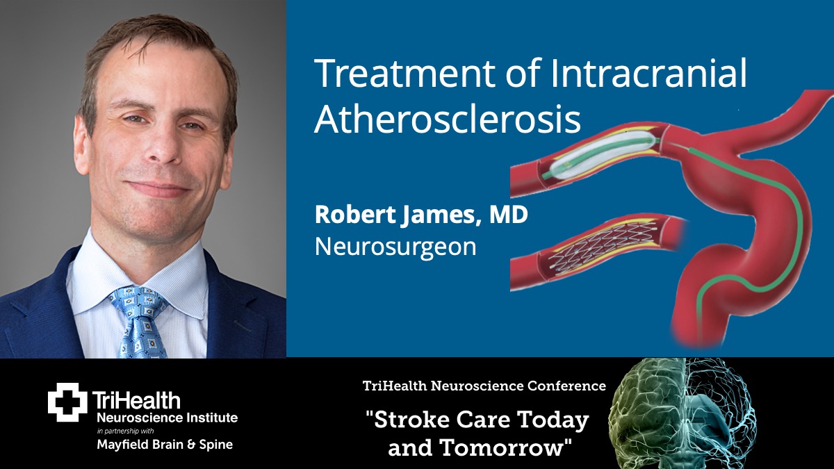 Neurosurgeon Dr. Robert James will give medical personnel an inside look into the next generation of #strokecare. His presentation is part of the @TriHealth Neuroscience Conference on May 2. Health care providers, register here. bit.ly/TH_Neuroscience #stroke #Neurosurgery