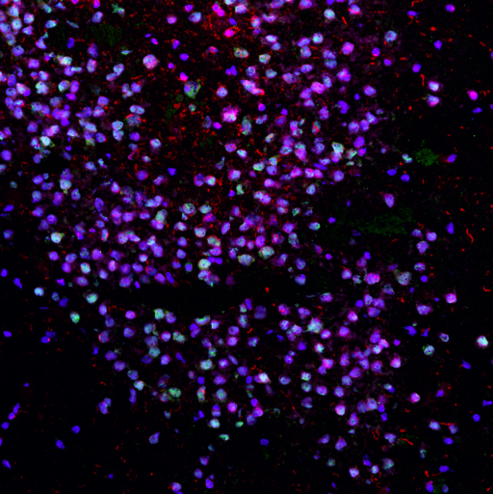 Because I am just loving the shades of purple here 💜 - labeling subpopulations of neurons in the human dentate gyrus - image credit to Lexy Papariello from @LieberInstitute Imaging Development/Microscopy Core team #FluorescenceFriday 💜🔬🧠