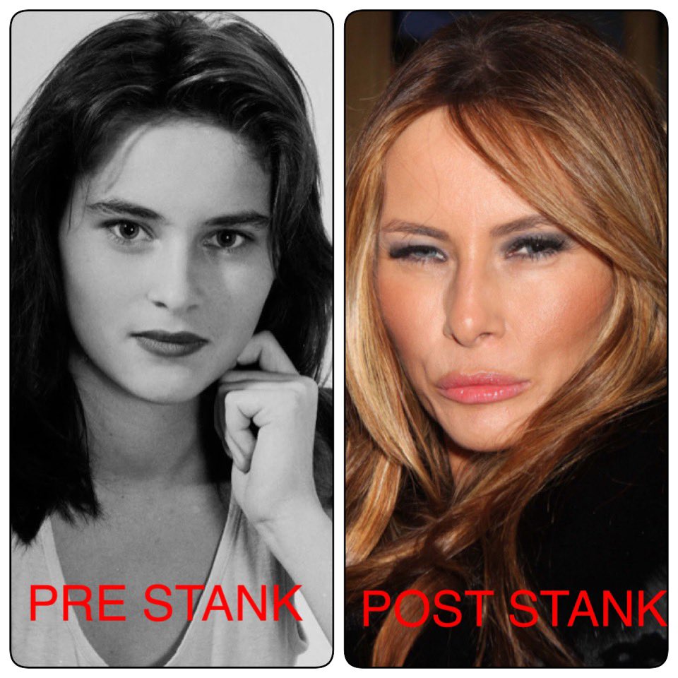 Melania seen here in a Pre Stank photo and Post Stank. Being around Grandpa Shits His Pants is obviously hard on the eyes.