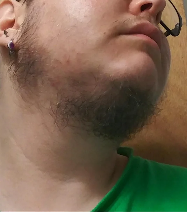 FiremanJonas tweet media