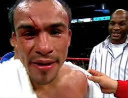 Sin pretextos, existe boxeadores con heridas horribles y aún así ganan peleas #tszyufundora #Boxeo #Boxing #ボクシング ​​#бокс #boxen #권투 #มวย #拳击 #Boxe #Tinju #Fistiana #bax