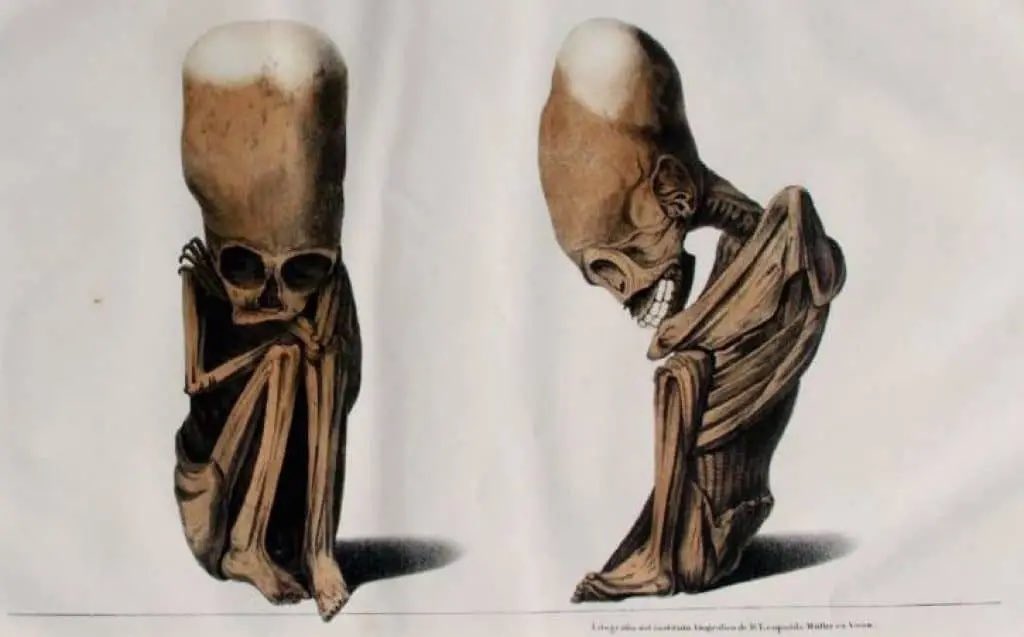 @_tattoos_4life Probably because they’re smarter

Copy of Egyptian statue of the daughter of Amenhotep IV. Original copy dates to 3,000 BCE-1,000 BCE (left)…. Rivero and Tschudi’s fetus with naturally elongated head from their 1851 ‘Antigüedades peruanas (right)