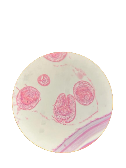 biotinucm's tweet photo. Volvemos con una nueva entrega de Microtin. En el día de hoy contamos con estas preparaciones: 𝑆𝑝𝑖𝑟𝑜𝑔𝑦𝑟𝑎, cocos Gram +, anafase de 𝐴𝑙𝑙𝑖𝑢𝑚 𝑠𝑎𝑡𝑖𝑣𝑢𝑚y sección de quiste hidatídico en 𝐸𝑐ℎ𝑖𝑛𝑜𝑐𝑜𝑐𝑐𝑢𝑠 𝑔𝑟𝑎𝑛𝑢𝑙𝑜𝑠𝑢𝑠 #microscope #microscopio #biology https://t.co/gx9BO59qQC