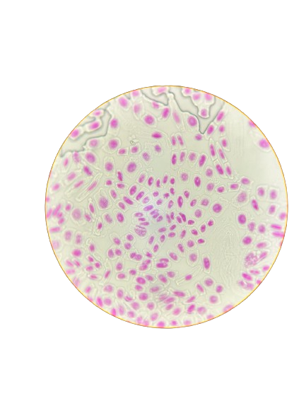 biotinucm's tweet photo. Volvemos con una nueva entrega de Microtin. En el día de hoy contamos con estas preparaciones: 𝑆𝑝𝑖𝑟𝑜𝑔𝑦𝑟𝑎, cocos Gram +, anafase de 𝐴𝑙𝑙𝑖𝑢𝑚 𝑠𝑎𝑡𝑖𝑣𝑢𝑚y sección de quiste hidatídico en 𝐸𝑐ℎ𝑖𝑛𝑜𝑐𝑜𝑐𝑐𝑢𝑠 𝑔𝑟𝑎𝑛𝑢𝑙𝑜𝑠𝑢𝑠 #microscope #microscopio #biology https://t.co/gx9BO59qQC