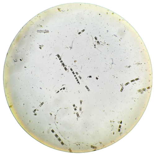biotinucm's tweet photo. Volvemos con una nueva entrega de Microtin. En el día de hoy contamos con estas preparaciones: 𝑆𝑝𝑖𝑟𝑜𝑔𝑦𝑟𝑎, cocos Gram +, anafase de 𝐴𝑙𝑙𝑖𝑢𝑚 𝑠𝑎𝑡𝑖𝑣𝑢𝑚y sección de quiste hidatídico en 𝐸𝑐ℎ𝑖𝑛𝑜𝑐𝑜𝑐𝑐𝑢𝑠 𝑔𝑟𝑎𝑛𝑢𝑙𝑜𝑠𝑢𝑠 #microscope #microscopio #biology https://t.co/gx9BO59qQC