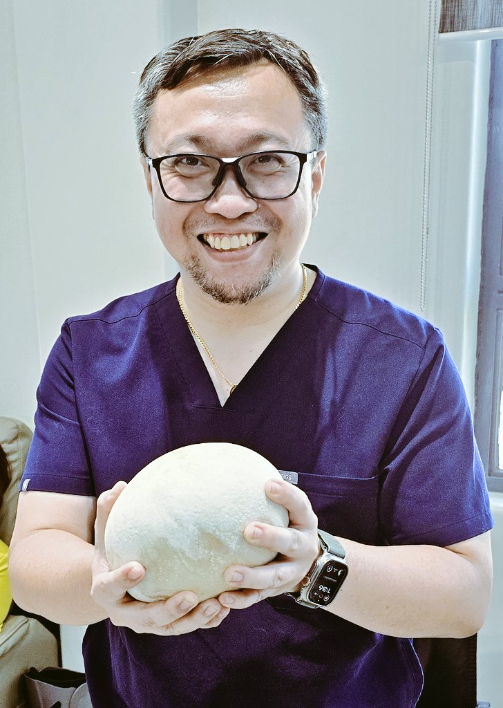 iamdockarl's tweet photo. @drkeithsiau I got it for you 😅👌 #BladderStone #Cystolithiasis #Urology https://t.co/c39wjukRAH