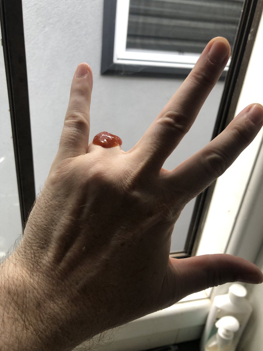 joshshiptonland's tweet photo. Ouch…
#killjosh https://t.co/fFW0iiwDOB