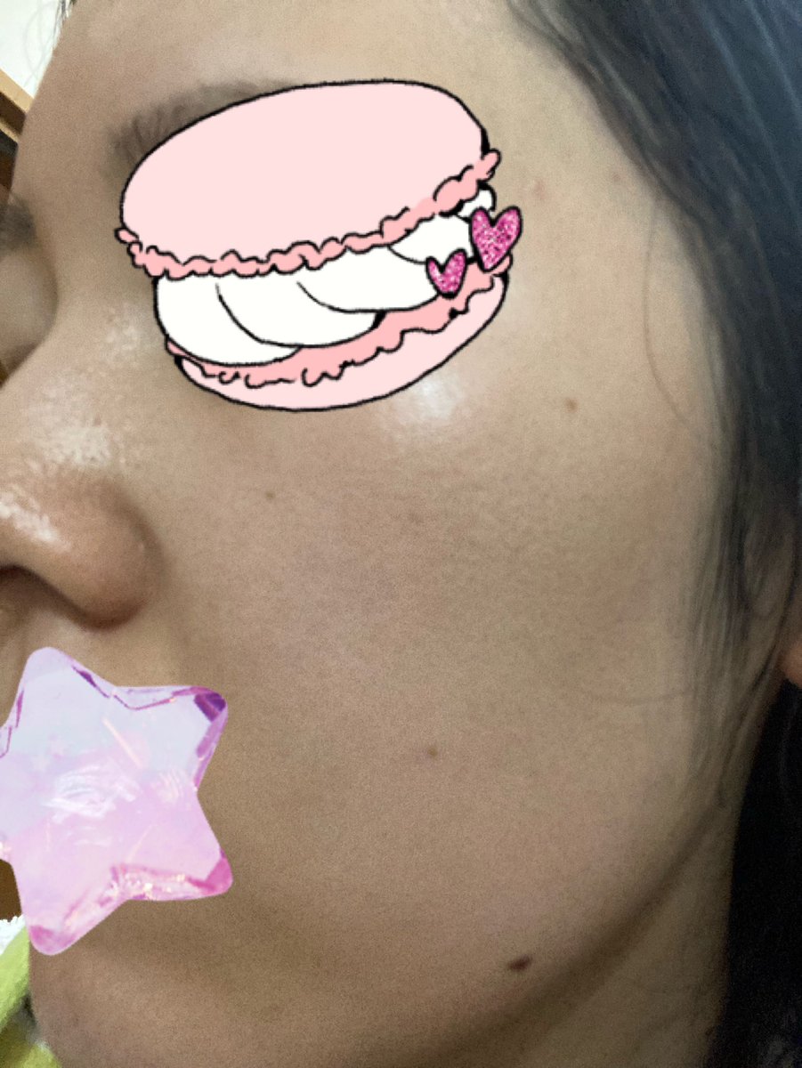 ahahaniikiru's tweet photo. @beauty_info_h 肌の厚みに関する記事購入させていただきました！ツイートをみてnarsのライトリフレクティングをTUを受けたら綺麗で感動しました(ただモンブランだと暗くて、オスロだと明るすぎて合う色がありませんでした)🥺クマを隠そうとコンシーラーを塗った瞬間肌が汚くなります…やはり私は薄肌なのでしょうか… https://t.co/JSeJgbpIVi