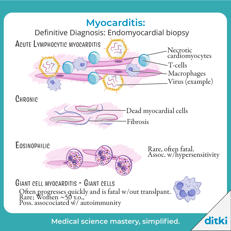 What are some top causes of myocarditis? Get answers: l8r.it/1YvG #ditki #usmle #meded #medschool #medstudent #highered #pathology #usmletutorials #myocarditis #nursing #pance #physicianassistant #osteopath #allopath #medicine #science #healthscience #nurse #mbbs