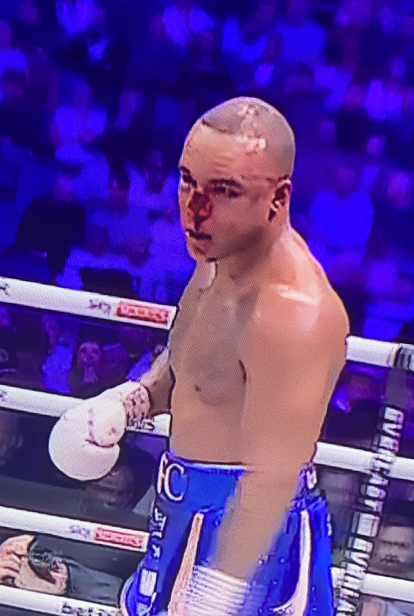 Rob- BoxingShrew 🥊🇬🇧 tweet media