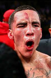 No hubo ríos de sangre pero una lesión de "Fractura de quijada" sin pretextos Ganó la pelea #TszyuFundora #Boxeo #Boxing #ボクシング #бокс #boxen #권투 #มวย #拳击 #Boxe #Tinju #Fistiana #bax