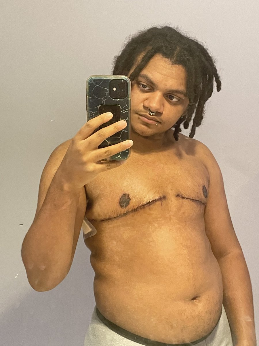 Bleatjio's tweet image. Happy #TransDayOfVisibility 🏳️‍⚧️
March marks my two years on HRT and 4 months since my surgery! I am valid, I exist and so do YOU!

With love from myself and my trans cast of sonas 💜
✂️ @PJCatStudio &amp;amp; @karasukeii