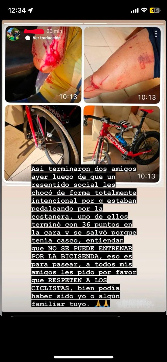 primeraPY's tweet photo. 🔴CICLISTAS ATROPELLADOS EN ZONA DE COSTANERA 
📽️Video muestra como un automovil atropella a dos ciclistas arrastrándolos unos metros 

Reportan que uno de ellos terminó con más de 30 puntos en la cara 

Se desconoce dueño del móvil y apuntan a que el atropello fue intencional https://t.co/JmjaPyqmey