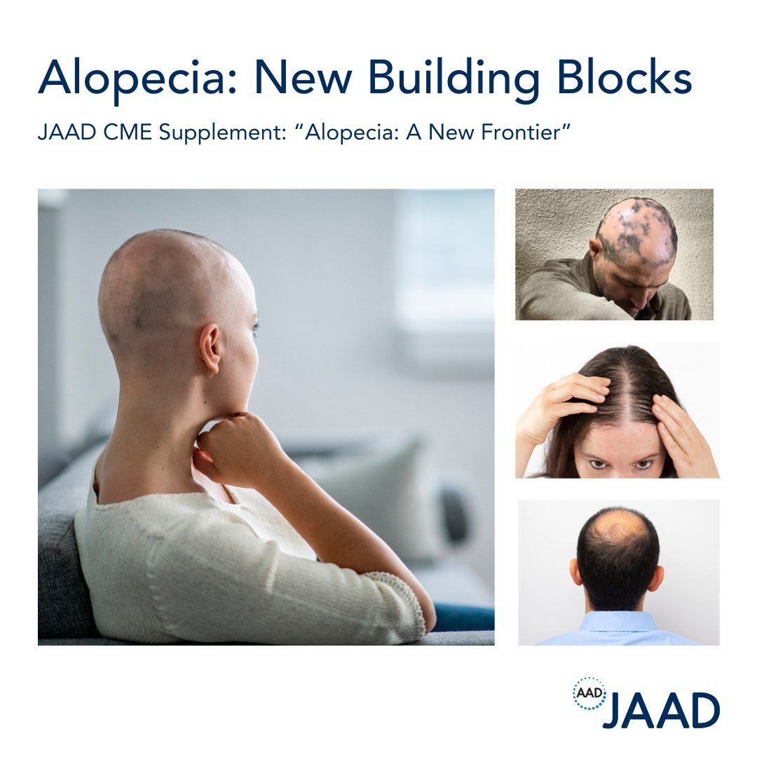 #Alopecia is devastating for the patient, but the diagnosis and treatment can be difficult for dermatologists as well. This CME activity focuses on the identification of, and distinction between, diverse types of hair loss, with strategies to manage them. jaad.org/article/S0190-…