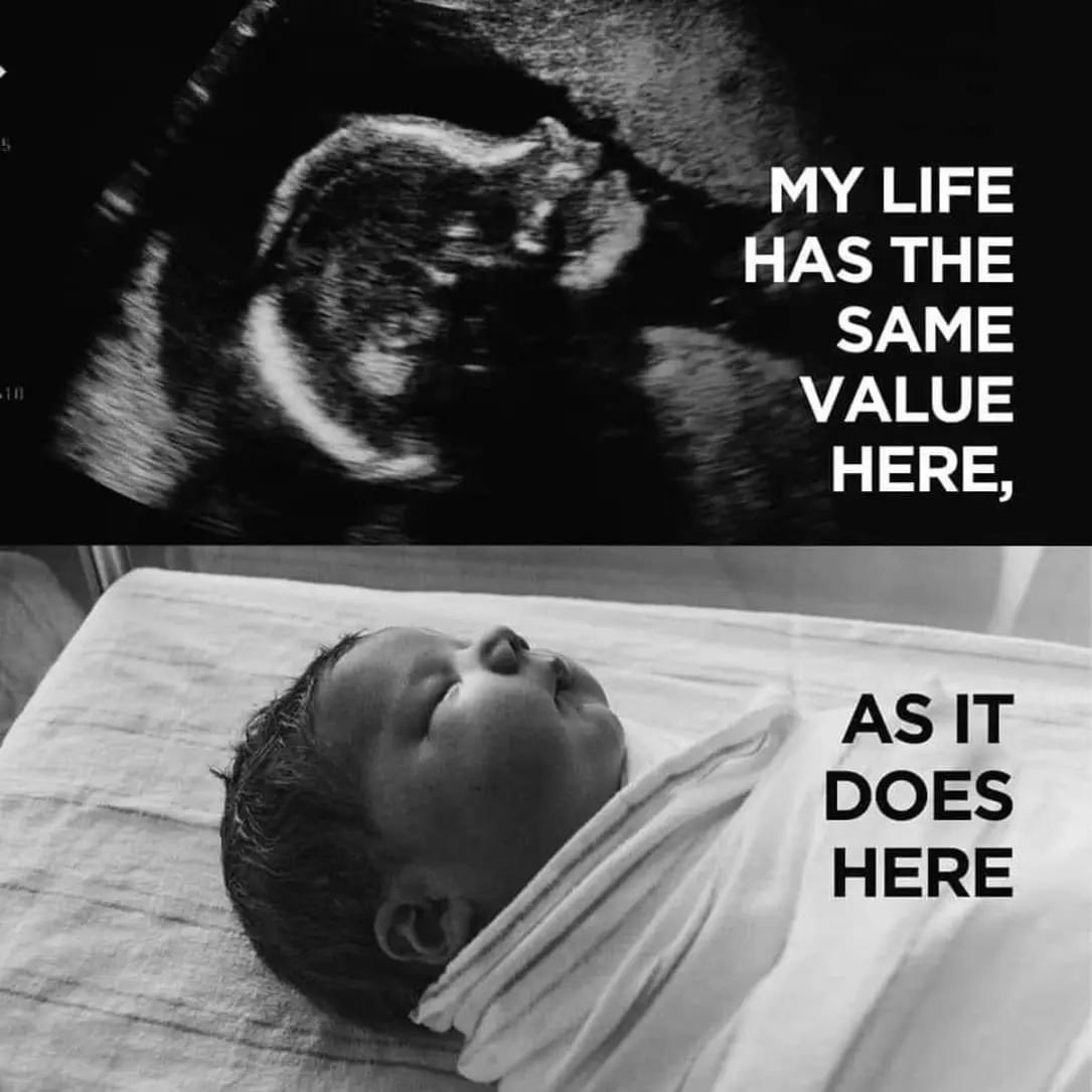 ❤️🫶 ITS SO TRUE #LifeMatters  #Value #baby #UnbornBabies #Life #LifeisValued