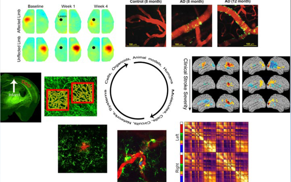 Neurophotonics calls for papers on Understanding Brain Disease with Live Imaging. 𝐀𝐩𝐩𝐥𝐢𝐜𝐚𝐭𝐢𝐨𝐧𝐬 𝐭𝐨 𝐛𝐫𝐚𝐢𝐧 𝐝𝐢𝐬𝐞𝐚𝐬𝐞 and technology developments are welcome! Guest Editors: @adamqbauer, @BistraIordanova, @SN_Lab #Neurophotonics #Neuroscience #fNIRS