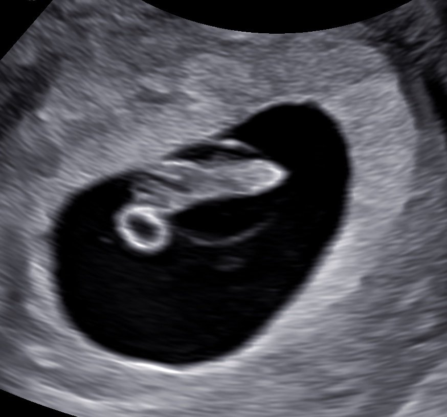 Pan1cPandaa tweet media