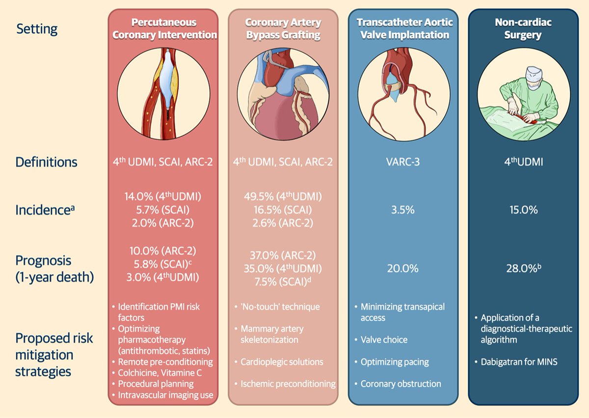 Various definitions for diagnosing periprocedural myocardial infarction (PMI) and injury have been developed and tested over time, posing challenges in clinical practice and complicating trial design and interpretation. The 5th Universal definition of myocardial infarction will…