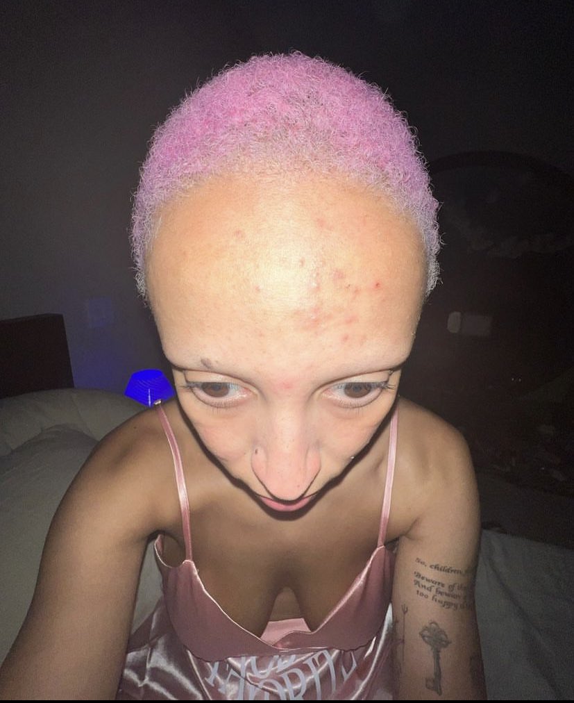 bigcomfyyy's tweet image. Thread of female musicians looking different with no makeup😱🤯

Read to the end✨

10. Doja Cat