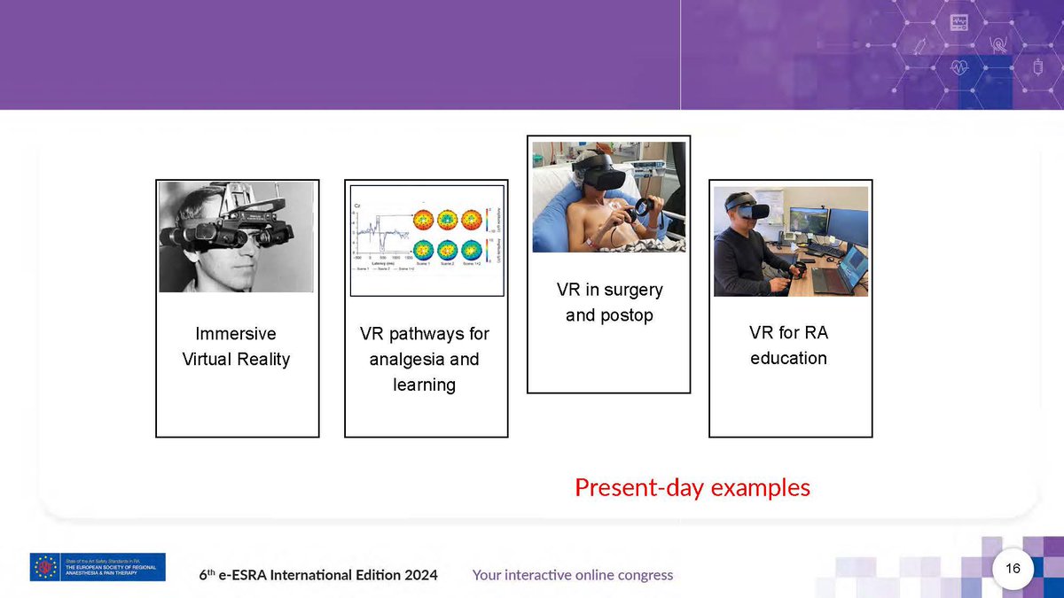 A teaser for my talk on “VR and regional anaesthesia” in the AI and new technologies session at #eESRA2024. What’s the role of VR in clinical #RegionalAnesthesia and for training in RA? Find out more this weekend, see you online! esra.e-congress.com @ESRA_Society
