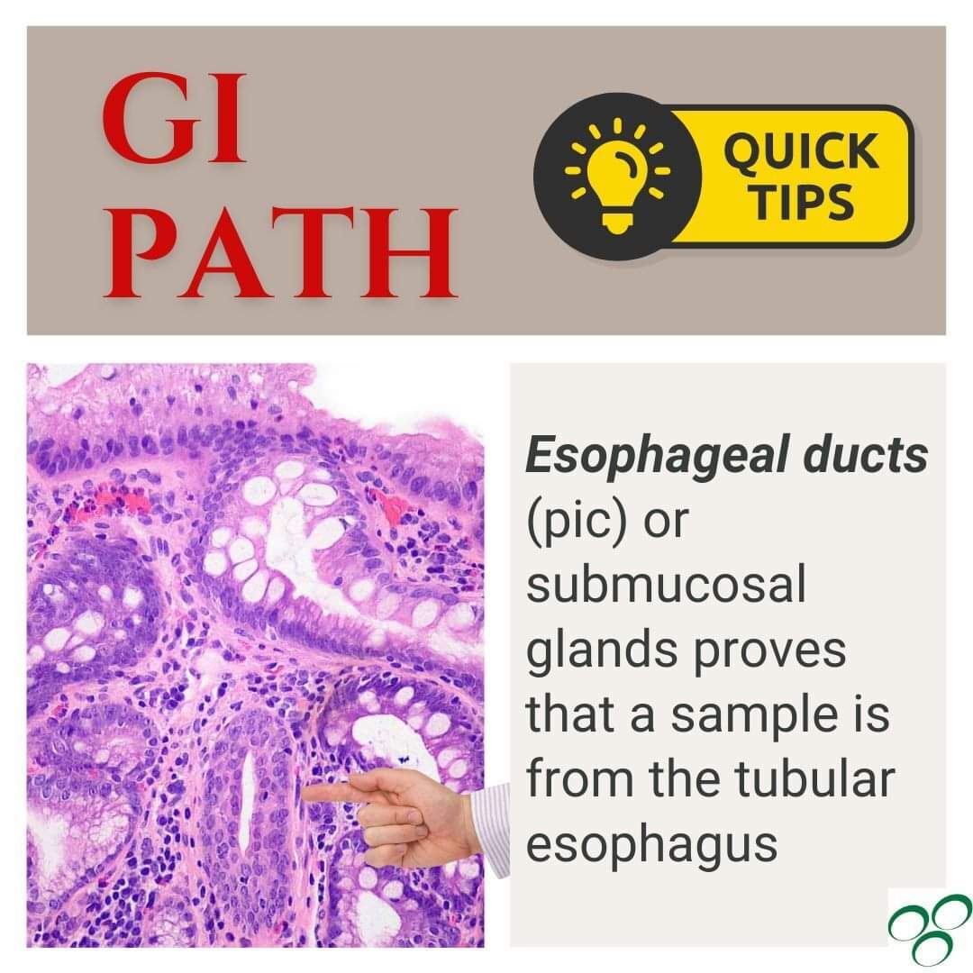 GeronimoJrLapac's tweet photo. Barrett's is suspected and columnar epithelium is seen in your sample. How do you know if it's from the tubular esophagus?
#pathplus #pathology #pathologist #gipath https://t.co/CHTBQwiZp8