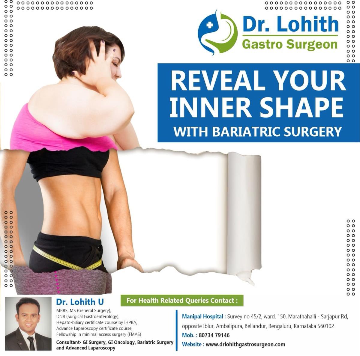 Reveal your inner shape with Bariatric surgery

#drlohith #drlohithu
#gastroenterology #gastrocare #gastrocarehospital #bangalore_insta #bangalore 
#gastrohealth #gastrohealth #Bariatricsurgery #bariatricsurgeon #Sarjapur #obesity #weightlossproblem #weightloss #obesityproblem