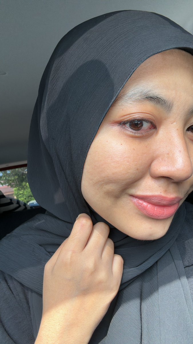 anisaniesa's tweet photo. I nak panggil serum ni serum anti jerawat la. Lepas dah guna triple action serum Zarzou sampai dah nak habis. I yakin akan repeat botol kedua nanti 

First time tau waktu period tak naik jerawat langsung, kulit i behave gila. Memang tak ada sebab lain, sebab serum ni la https://t.co/BoYiq0bKV0