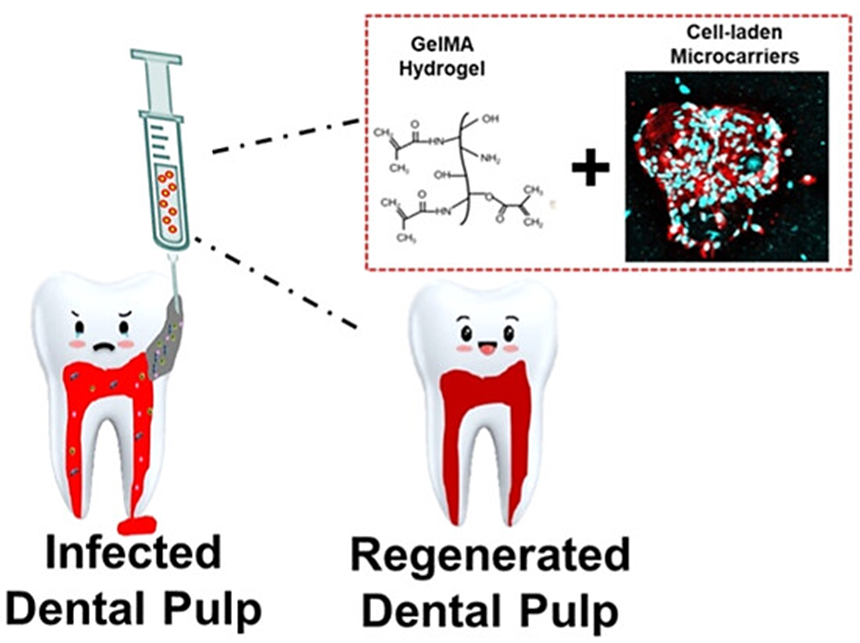 Injectable microcarrier-hydrogel composite for dental stem cell delivery and tissue regeneration
@Wiley_Chemistry @WileyEngineer @wileyinresearch @InnovationChem @isciverse @Mat_Innov @AdvSciNews 

doi.org/10.1002/smm2.1…