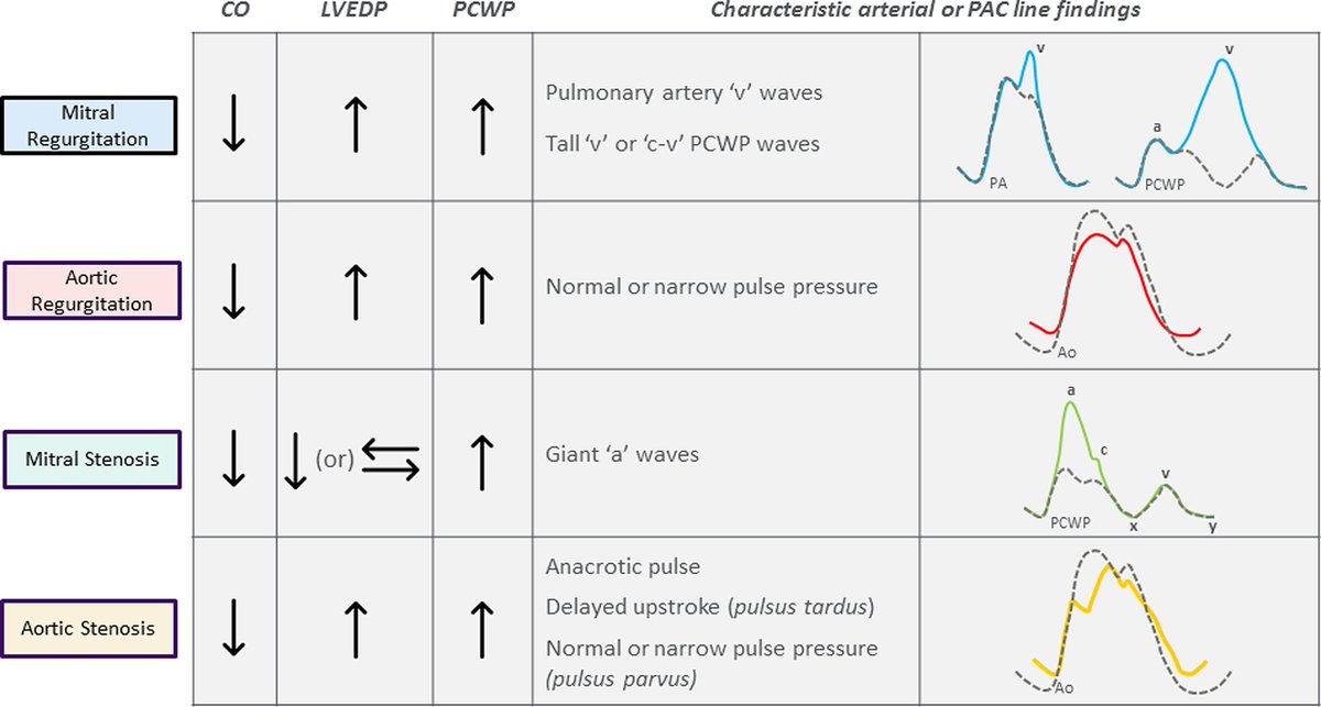 Today's Paper of the Day is on acute valvular emergencies criticalcarereviews.com/latest-evidenc… Join us to read 1 paper per day and stay up-to-date as we cover the spectrum of critical care across 2024