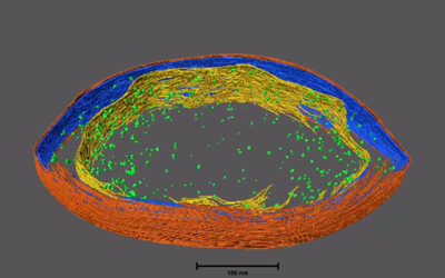 A Whiff of Taxonomy – Atribacter laminatus by Christoph — The image is way too large to show it here, but when you join me and Hug et al. (2016) for 'A new view of the tree of life' here, you can spot a bunch of names of bacterial phyla in... Read more > tinyurl.com/bdznnd54