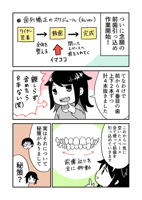 人生二度目の歯列矯正した話【6話】(1/2)#レポ漫画#エッセイ漫画 #漫画が読めるハッシュタグ 