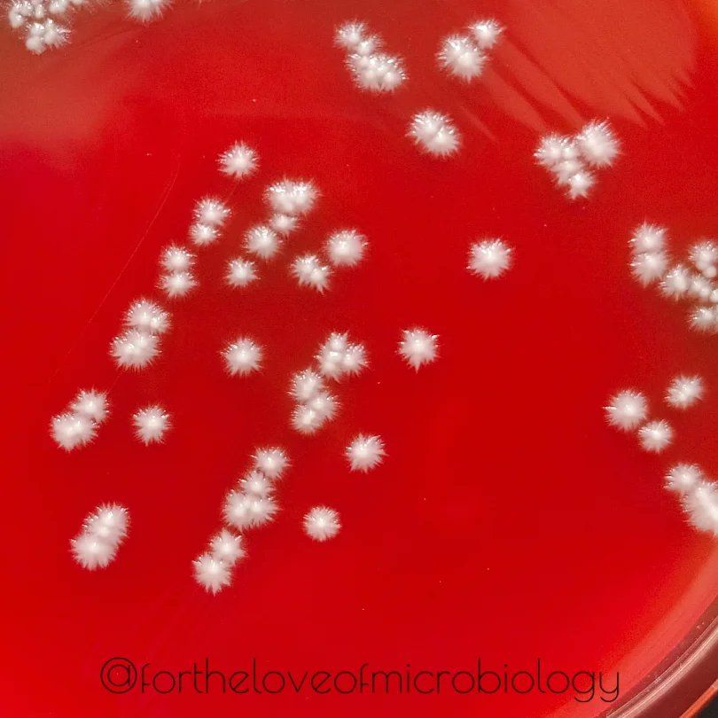 Candida albicans on blood agar,  with starry projections.

#Fortheloveofmicrobiology #clinicalmicrobiology
#mmidsp #microrounds #IDpath #ASMClinMicro #MicroTwitter #WomenInSTEM #WomeninMicrobiology #STEM #medtwitter #ClinMicro #microbiologypakistan #PathBugs