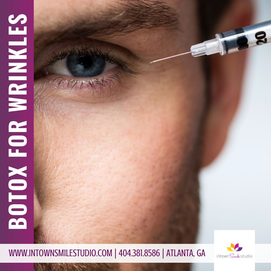 Our Botox treatments are designed to reduce fine lines and wrinkles, leaving you with a refreshed and rejuvenated appearance. Trust our experienced team for natural-looking results you'll love. 

Call us ☎️ 404-381-8586
#DrSusanEstep #InTownSmileStudio #Botox #WrinkleFree