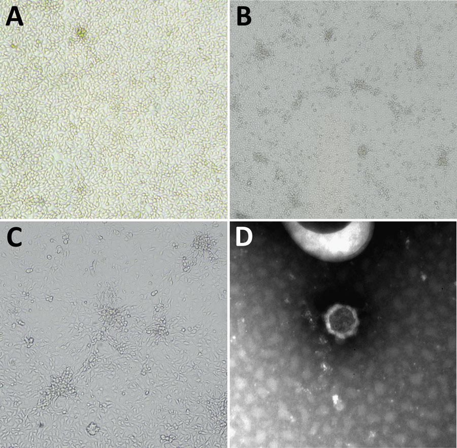 Issyk-Kul virus (ISKV) was isolated from a #bat sampled from Italy in 2021 and ISKV surveillance was conducted in bats collected in Italy during 2017–2023. Learn more in this April 2024 EID journal article: bit.ly/499ueHt (Authors: Davide Lelli, et al.) @davide76173