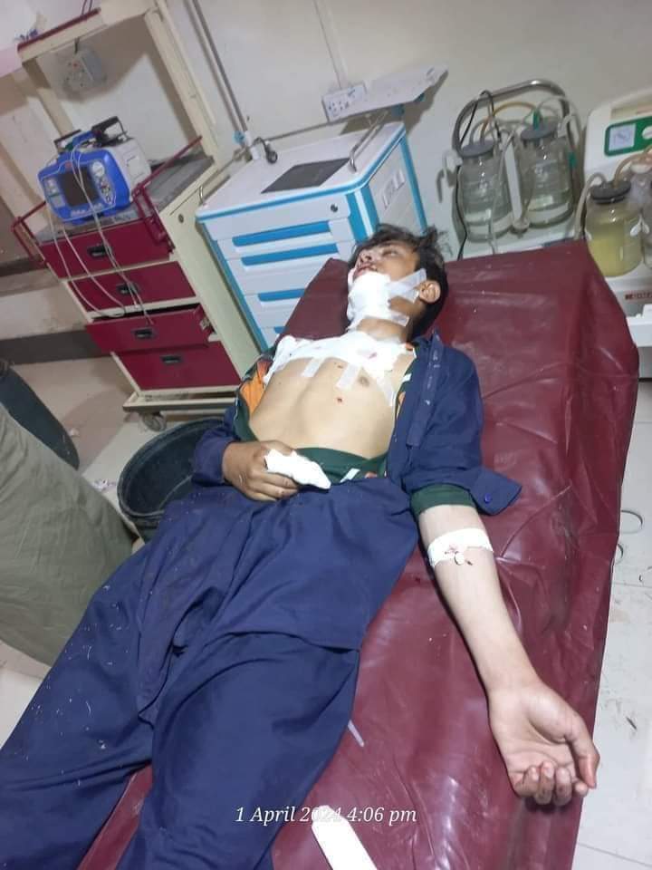 A bomb exploded in Miranshah Dandi, North Waziristan, two children aged 14 and 15 were injured in this bomb blast. And at this time both the injured persons have been taken to Miranshah Military Cantt Hospital
#stopstateterrorisminwaziristan