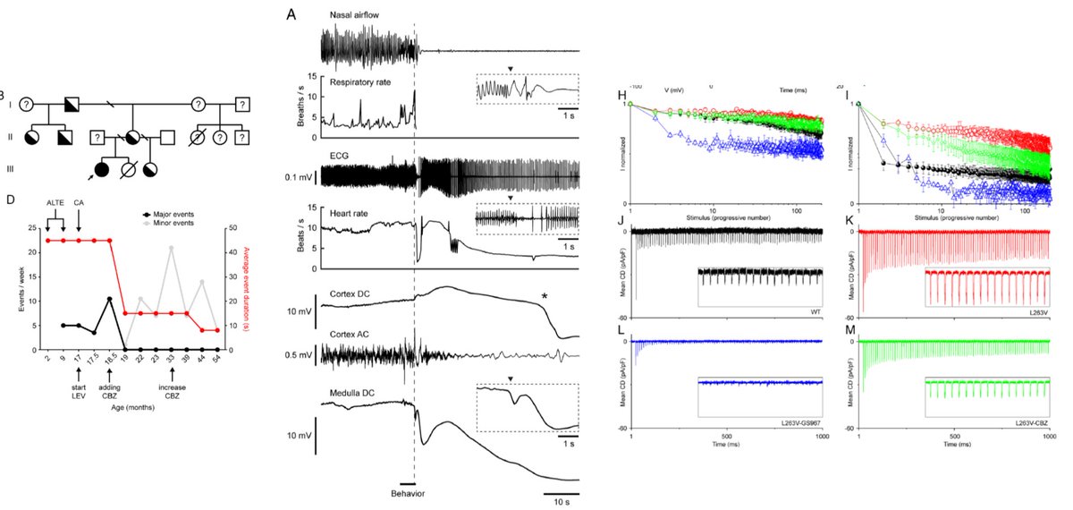 Massimo Mantegazza (@mantegazzamassi) on Twitter photo New lab's paper. NaV1.1/Scn1a phenotype: homozygous patient's gain-of-function variant causes life-threatening apneas and brainstem depolarization; responds to sodium channel blockers. pnas.org/doi/10.1073/pn…. With S.Cestele, E.Tolner, <a href="/a_brunklaus/">Andreas Brunklaus</a> , A.van den Maagdenberg, et al. New lab's paper. NaV1.1/Scn1a phenotype: homozygous patient's gain-of-function variant causes life-threatening apneas and brainstem depolarization; responds to sodium channel blockers. pnas.org/doi/10.1073/pn…. With S.Cestele, E.Tolner, <a href="/a_brunklaus/">Andreas Brunklaus</a> , A.van den Maagdenberg, et al.