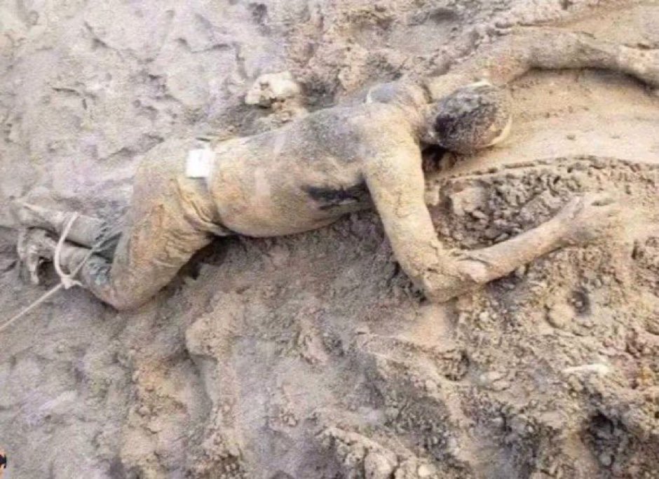 اسرائیلی فوج نے الشفا اسپتال کا طبی عملے کے  ہاتھ پاؤں باندھ کر قتل کر کے ان کی لاشوں کو بہار زمین پر رگڑایا گیا