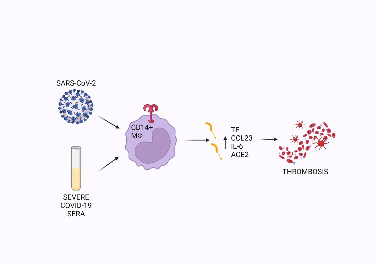atvbahajournals's tweet photo. COVID-19 may trigger tissue factor release, promoting blood clot formation. This heightened thrombogenicity, coupled with inflammation, underscores the severity of vascular complications in the disease. Und... #COVID19 #TissueFactor #BloodClots" @sngoonew
https://t.co/450NRZamdU https://t.co/zAlUnya7Ic