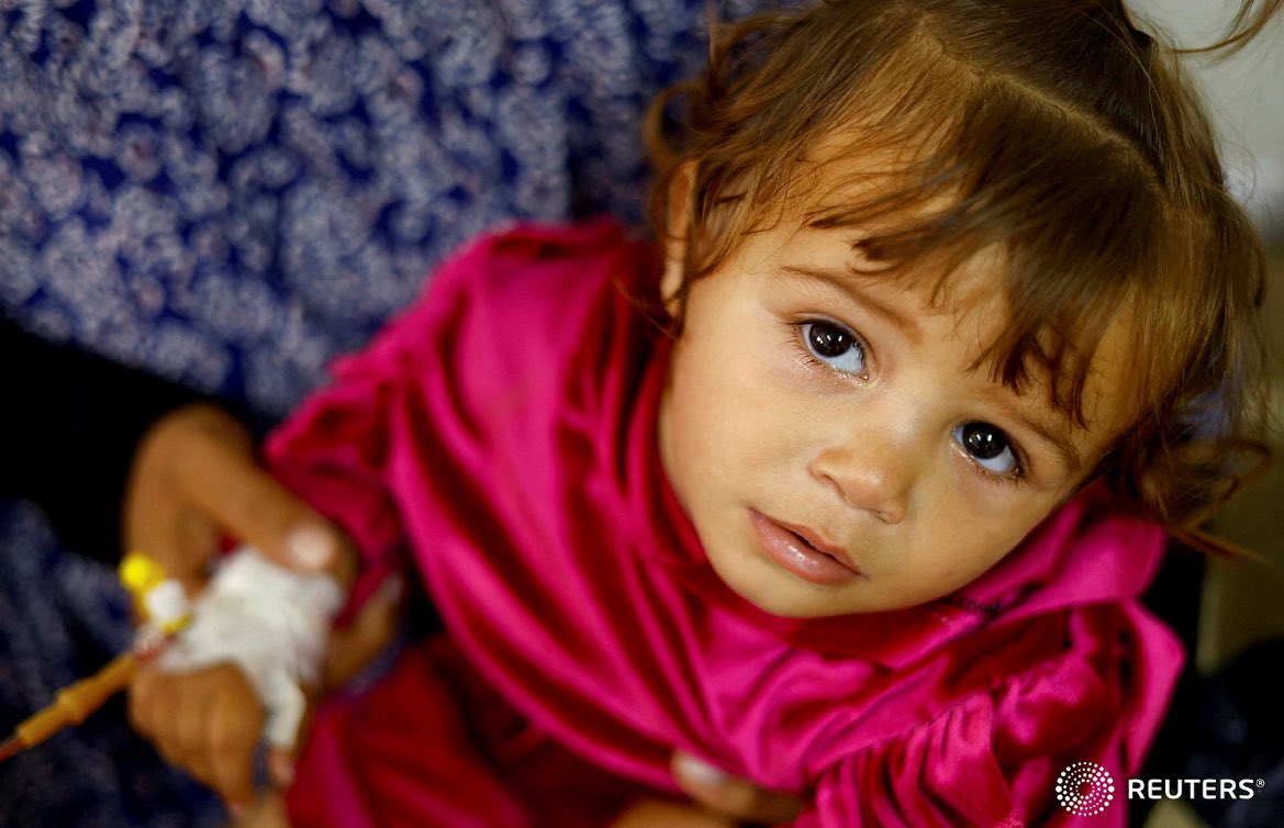 1. Thread on Reuters’ images of Palestinian children suffering from malnutrition receiving treatment at al-Awda health centre, amid widespread hunger, in Rafah, in the southern Gaza Strip April 1, 2024. REUTERS/Mohammed Salem