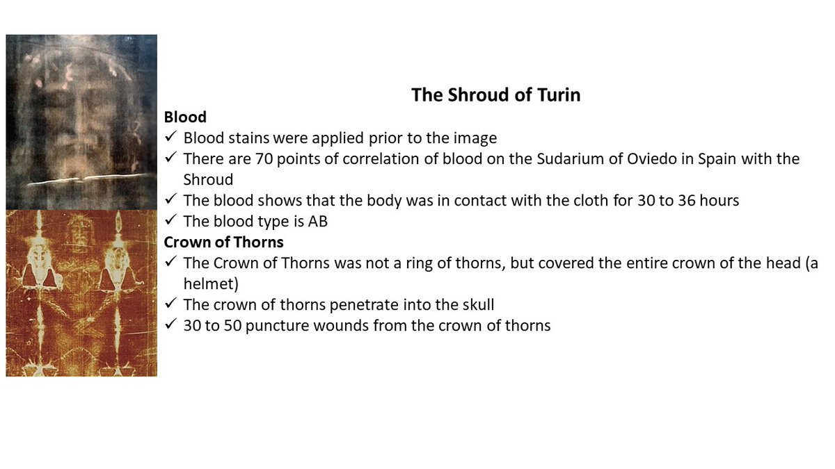 Some facts about the #ShroudOfTurin 
(some of the facts may be replicated, oh well.)
#Catholic 
#Christian 
#easter