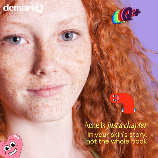 demark_q's tweet photo. Acne is just a chapter in your skin's story – a plot twist, not the final page. Let's flip through the rest of the book together and embrace the journey to clearer, happier skin! 📖✨

#demarq #skincare #skincareroutine #skincareproducts #skincarecommunity #skincaretips #acne https://t.co/Vewv740vsf