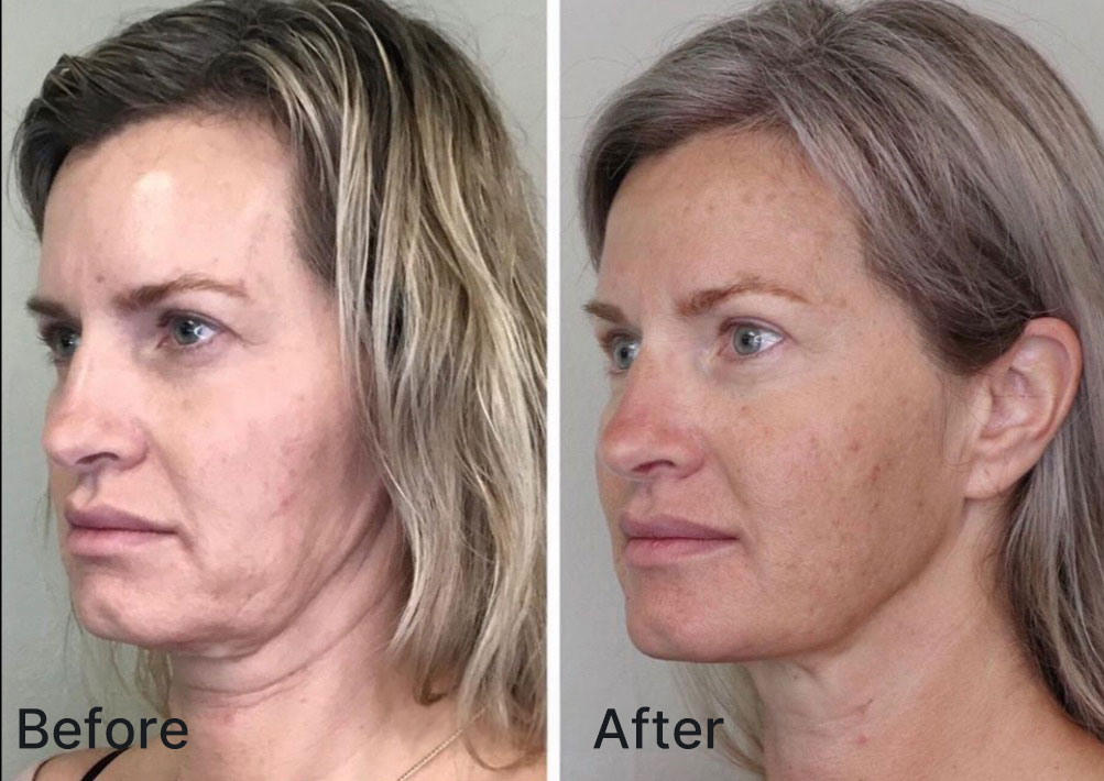 thefixstudios_'s tweet image. 🌟Discover the secret behind that celebrity glow with lifting threads! ✨ Minimal downtime, immediate results. Ready for a transformation? Dive into the world of lifting threads with us and redefine beauty on your terms. #LiftingThreads #BeautyRevolution #FixStudios