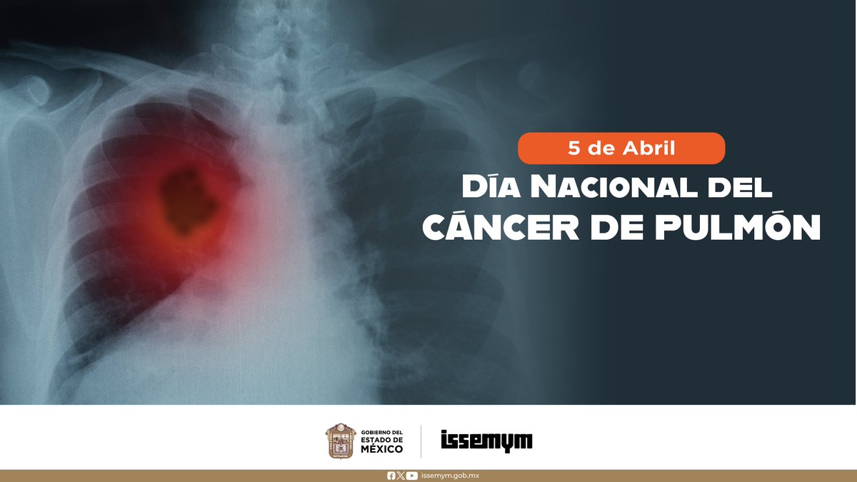 🟠 5 de Abril | Día Nacional del Cáncer de Pulmón. 🫁 En México el cáncer de pulmón es la cuarta causa de muerte, por ello se estableció esta fecha para concienciar sobre su prevención. #EquipoIssemym #CuidaTuSalud
