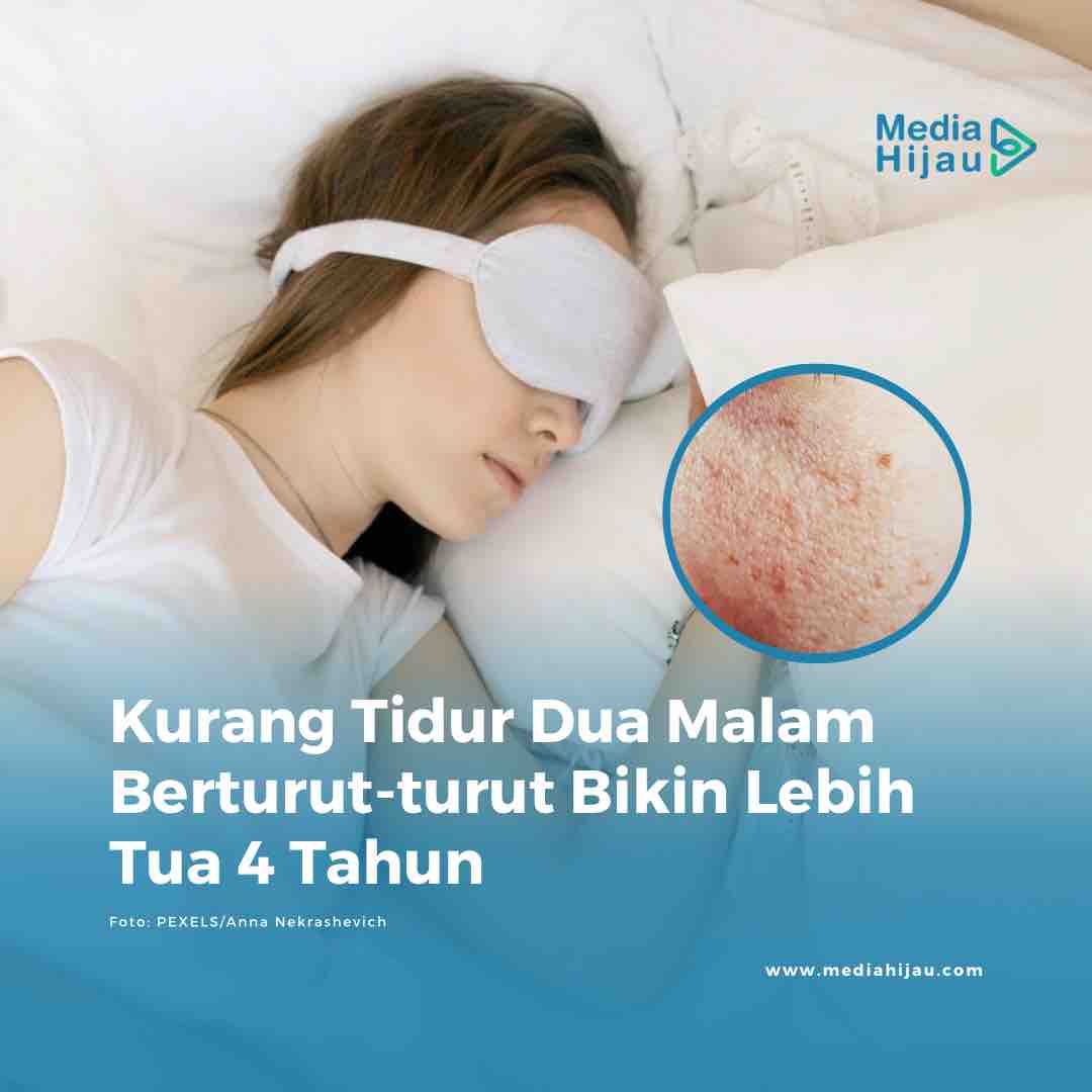 Penelitian terbaru mengklaim kurang tidur selama dua malam berturut-turut dapat membuat relawan studi merasa lebih tua rata-rata empat tahun. 

Baca di sini
mediahijau.com/read/kurang-ti…

#mediahijau #gayahidup #penuaandini #awetmuda #kesehatan