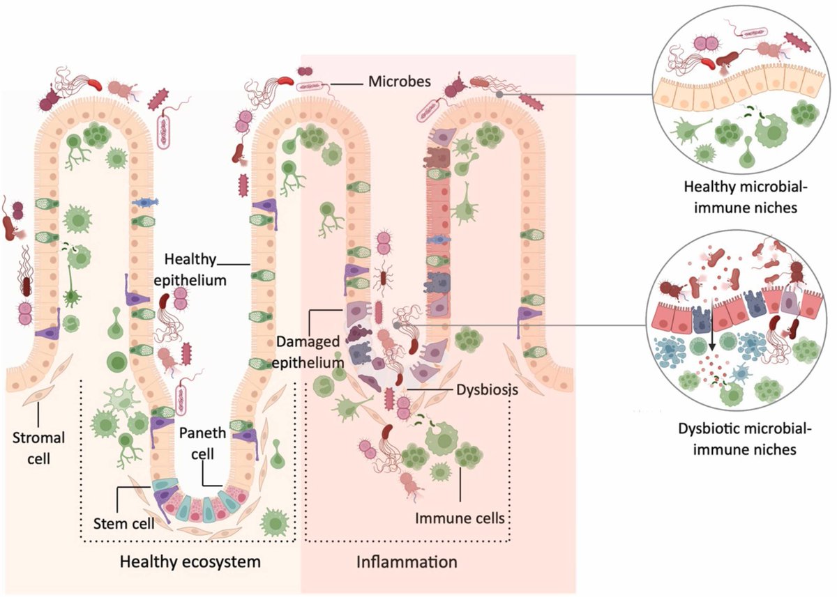 Symbiotic Symphony: our review on why catching #host #Microbiome dialogues in its true space matters! The key to #immunepriming & #PrecisionMedicine Kudos to @Soumi_Chatter for the smarts & grit in piecing together this puzzle 🔎🤩 #SpatialTranscriptomics authors.elsevier.com/a/1is5a3si8Pym…