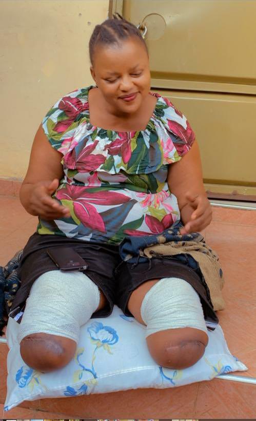 TumukundeTT's tweet photo. Violet Kokunda’s story was aired on @ntvuganda today. She suffers from diabetes which led to amputation of her legs. She cant walk because she has no money to buy a wheelchair amidst the expensive treatment. If my X family can send only Ugx.1000 on 0784290281, we can buy it. https://t.co/QsXfRWUDI7
