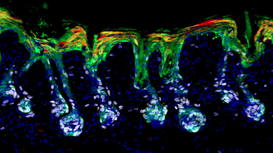 Skin stem cells have the amazing ability to transform into epidermal stem cells from hair follicle stem cells in response to wounds. This process, called lineage plasticity, can be controlled by retinoic acid: asbmb.org/asbmb-today/sc… @ASBMB @RockefellerUniv