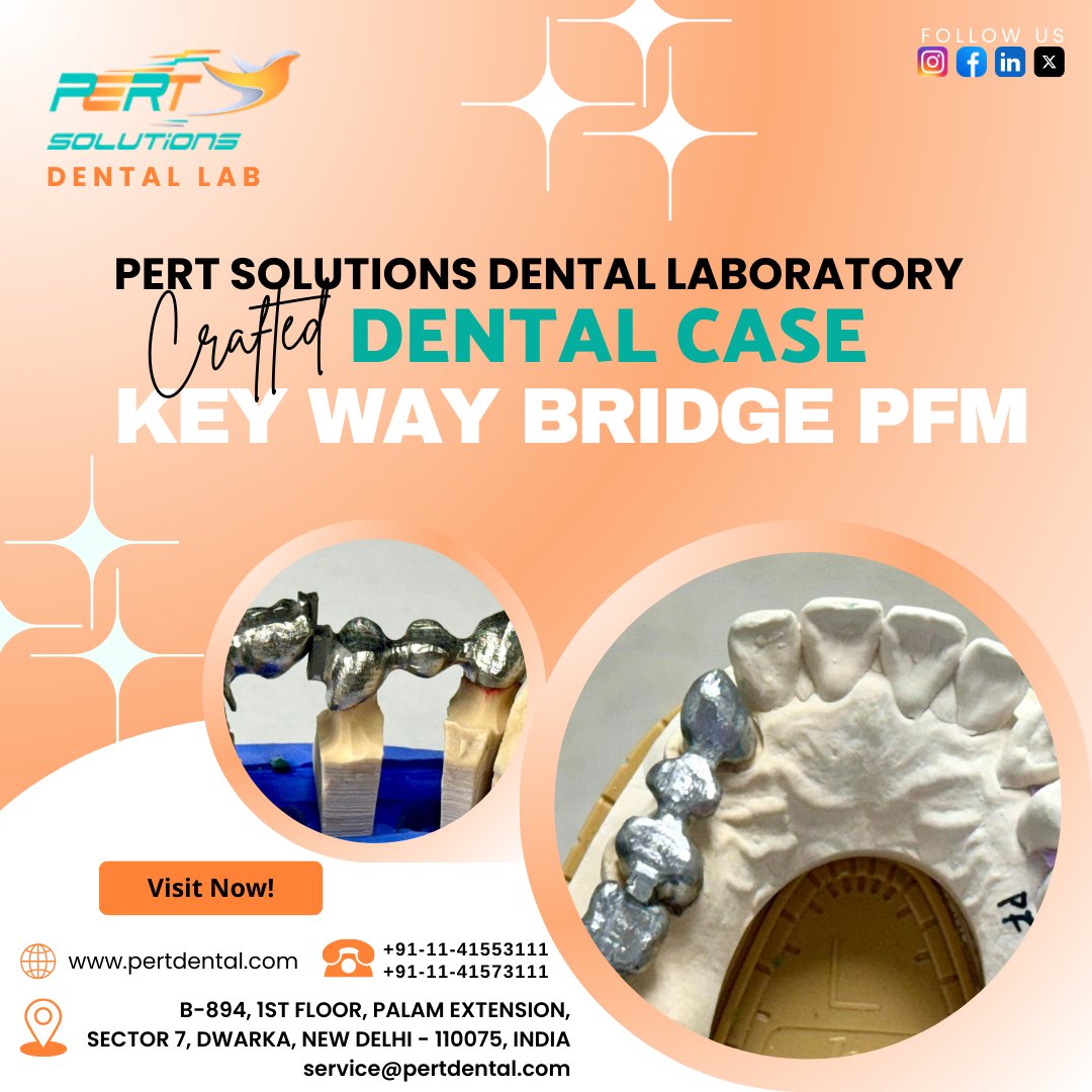pert_dental's tweet photo. Are you missing #tooth and concerned about the best way to replace it? #PertDental offer a variety of #dentalbridge options, and for some cases, the keyway bridge with porcelain-fused-to-metal (PFM) bridges might be the perfect solution for your #patients.
https://t.co/RZkDhP5eIT https://t.co/illyTMtGYK