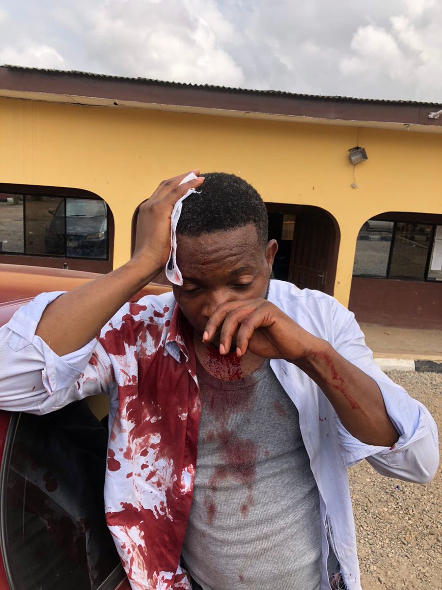 Exclusive interview: I want to know my offense says Tony Daniel, Journalist assaulted by Security Agents in Ibadan, Oyo State———facebook.com/share/p/DysfKu… @seyiamakinde @NigeriapolicePR @BBCAfrica @CNN @CNNAfrica @AlJazeera @channelstv @tvcnewsng @lindaikeji @officialABAT