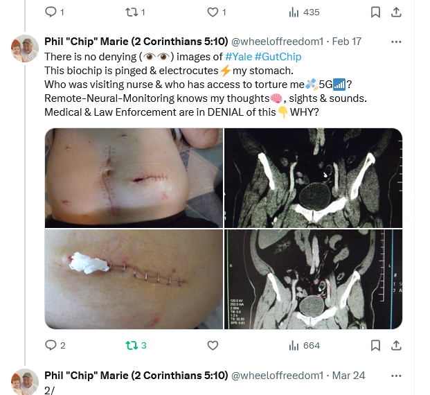wheeloffreedom1's tweet photo. I've spent 16yrs speaking to law enforcement on ALL levels, lawmakers, &amp; medical professionals, which resulted in NO HELP at all, but instead, being labeled and/or put on watch-lists🧐by them.
#JohnDurham CTDA's office has evidence provided to them by me,
still nothing! #FBI @FBI https://t.co/dwkAtuhssx